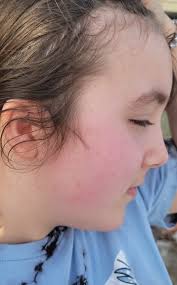 7th grade girl who witnessed bullying at junior high