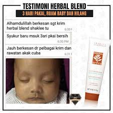 Anda mungkin mengalami marah melihat bayi anda memiliki ruam pada kulit. Krim Untuk Menghilangkan Ruam Pada Kulit Bayi Ziana Eunos