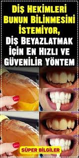 Dis Beyazlatmak Icin En Hizli Ve Guvenilir Yontem Dogal Dis Beyazlatma Dogal Guzellik Ipuclari Dogal