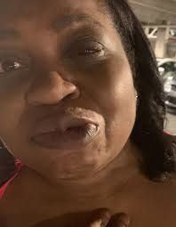 At first the doctors said I had Functional Nerological disorder ￼. A year  later this was found as a sign of Neuropsychiatric lupus . My body was  attacking my nervous system .