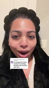 Centellin 24 Cream Review: Three Weeks for Glowing Skin