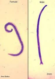 Phylum Nematoda Microbiology Nematode Body