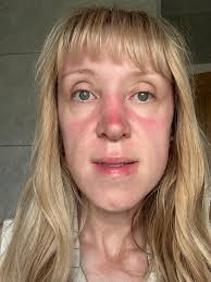 Should I see my pulmonologist about nightly fevers and wheezing?