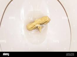 Image result for yellow stool human poop