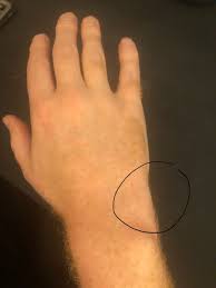 Image result for Pisiform Bone