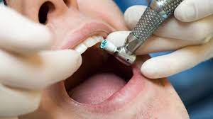 The People Who Can't Go Numb At The Dentist's - Bbc Future