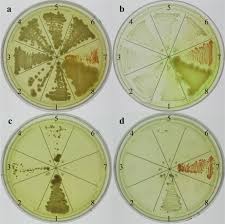 We did not find results for: Chronic Gamma Radiation Resistance In Fungi Correlates With Resistance To Chromium And Elevated Temperatures But Not With Resistance To Acute Irradiation Scientific Reports