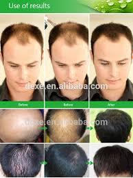Join the vip club now and 25% off Protein Powder Private Label Black Hair Thickening Fiber For Men Buy Hair Fibers Hair Thickening Spray Hair Thickener Product On Alibaba Com