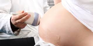 Itu sebabnya, volume air ketuban sebaiknya tidak boleh kurang maupun berlebih. Kenali Warna Air Ketuban Anda Apakah Termasuk Normal