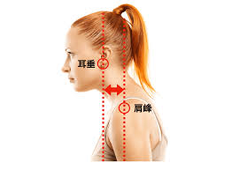 頭部前方位姿勢の特徴と臨床評価 - forPT ONLINE