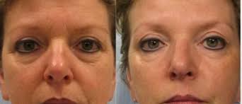 Catherine Carter Aesthetics & Beauty