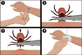Image result for infected tick bite