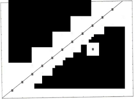 Visual Acuity Changes After Trabeculectomy Snellen Chart