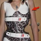 Descente cheneau korsett