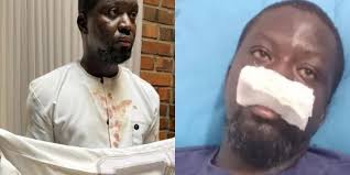 Ibrahim Mahama Considers Legal Action After Alleged Assault