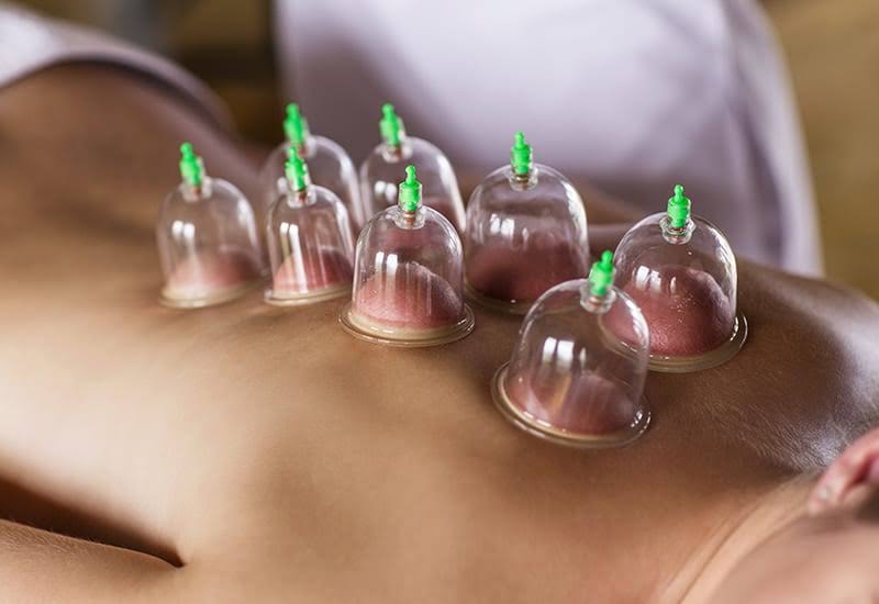 CUPPING product image