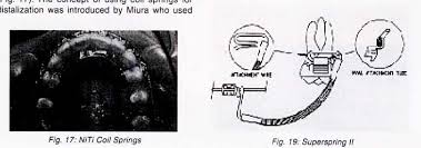 An orthodontic elastic separator was indicated as an alternative to fixed orthodontic appliances in order to recover the necessary space. Effective Means Of Intraoral Molar Distalization An Overview Semantic Scholar