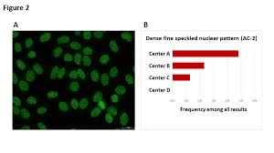 Image result for ANA Staining Pattern
