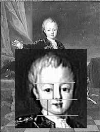 Anciennement : Nicolas Ferry, dit « Bébé », nain de Stanislas...