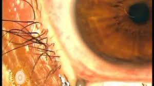 Videolar Adana Nivgoz Adana Maya Goz