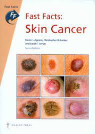 Skin cancer is by far the most common type of cancer. Skin Tumour Basics For Beginners The Medical Journal Of Australia