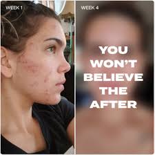 ABHISHEK NARAYAN (@avinarayan)