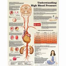 understanding high blood pressure chart poster laminated