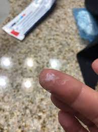 If you have had your period two weeks, or less, before you are experiencing the discharge, it is ovulation, she says. Family Magazine Discharge After Ovulation Sign Of Pregnancy