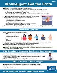 Monkeypox_ Get the Facts