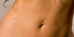 Namun, ada beberapa perawatan yang dapat membantu memudarkannya. 5 Cara Menghilangkan Stretch Mark Di Betis Alami Dan Efektif Merdeka Com