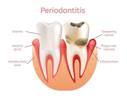 sylvan heights dental periodontal care portland or