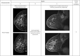 Image result for Inflammatory breast cancer