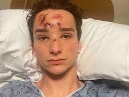 Aaron Partin's Instagram, Twitter & Facebook