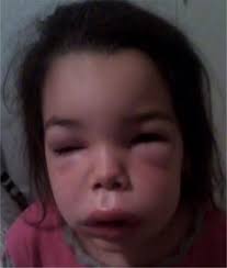 4th Pediatric Allergy and Asthma Meeting (PAAM)