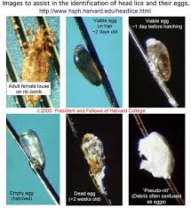Image result for lice vs nits