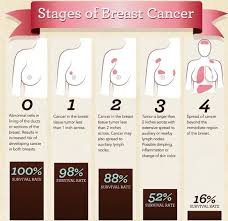 Image result for Breast Cancer Staging