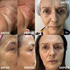 Estética Avançada em Três Pontas