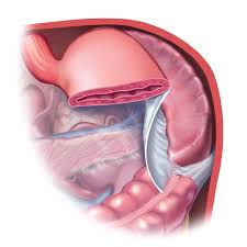 The spleen is the largest lymphoid organ and has a crucial function in the immune system. Laparoscopic Spleen Removal Splenectomy Patient Information From Sages