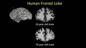 Humans Alone See Brains Shrink With Age Researchers Find Wsj