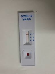 Coronavirus A Cada 100 Testes De Covid 19 Em Farmacia 15 Dao Positivo Indica Pesquisa