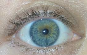 This eye doctor will do a routine eye exam to look for uneven or totally different pigment dispersion in one or both eyes. Central Heterochromia Eyes