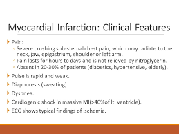 Cardiovascular System Ihd Angina Mi Ppt Video Online Download