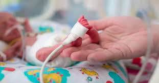 Image result for Preterm Infant