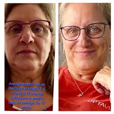 Cenla Occupational Medicine Service would like to let everyone know that  Kimberly Laborde, FNP, is not a DERMATOLOGIST! She is a Family Nurse  Practitioner with 14 years experience specializing in Dermatology. We