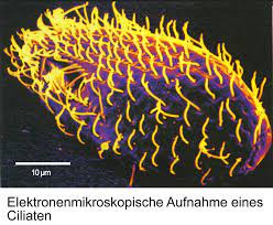Können Pantoffeltierchen Krebs heilen? | Presseportal