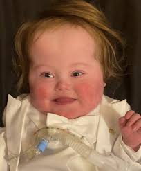 Chronic Lung Disease Conference