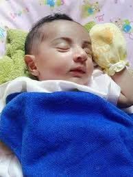 Majoriti daripada anak kembar adalah terdiri daripada kembar tidak seiras, di mana dua telur telah disenyawakan. Kiat Mendapatkan Anak Berwajah Tampan Dan Hidung Mancung Bangkitmedia