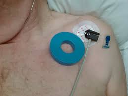 Pacemaker for iphone, ipad and apple watch. Pacemaker Taber S Medical Dictionary