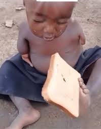 Yamah Massaquoi's inspiring words highlight her journey as a Liberian  female amputee football player. She shares a powerful message of resilience  and determination, emphasizing that challenges don't define us, but rather  how