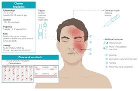 Image result for Acute Localized Headache